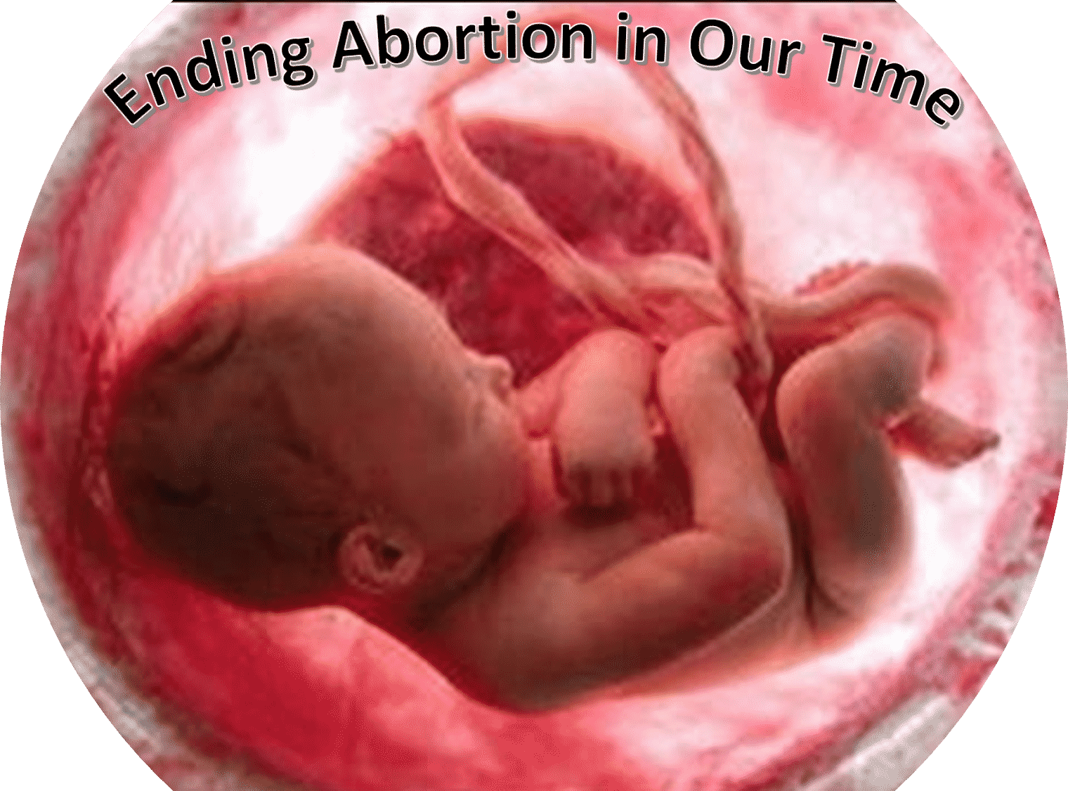 Strategies to Eliminate Abortion in Our Time